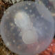 Image for article titled Embryos and Tumors Are Eerily Similar